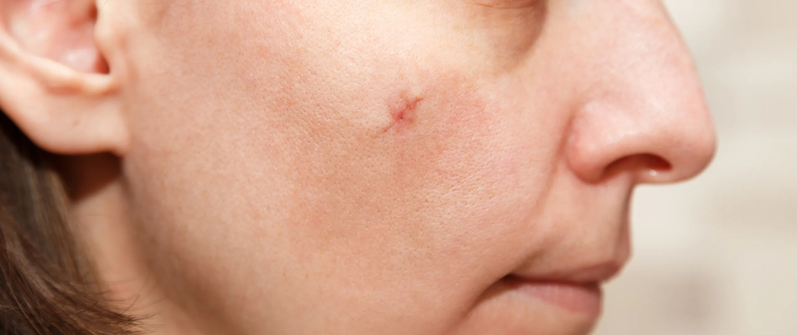 Reconstructive surgery enhancing physical appearance in Ohio