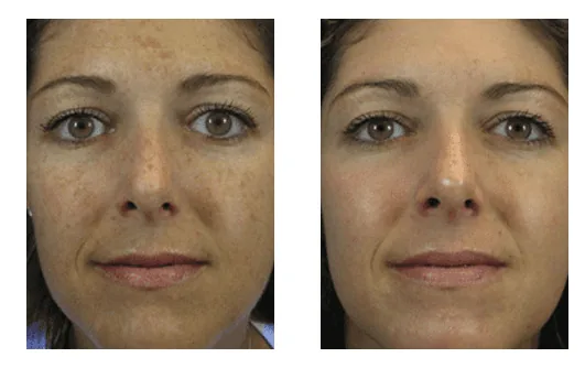 Healthy skin care routines for glowing and vibrant complexion